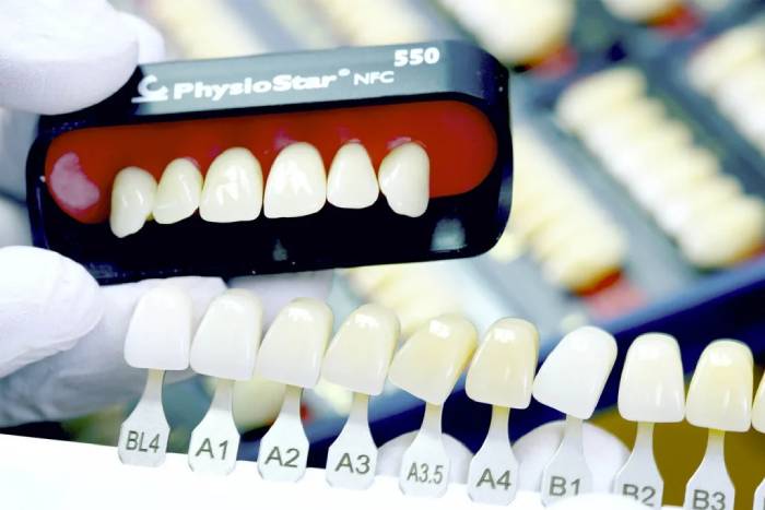 رنگ بندی کامپوزیت دندان