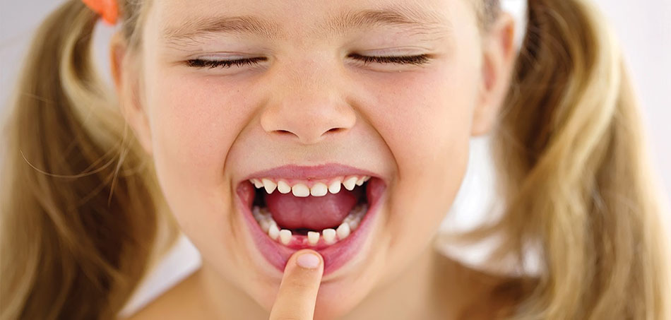 معاینه دندان شیری کودکان
