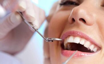 دندانپزشکی ترمیم - زیبایی