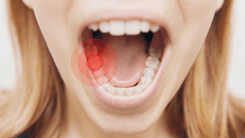 دلایل و عوامل درد پس از پر کردن دندان چیست؟