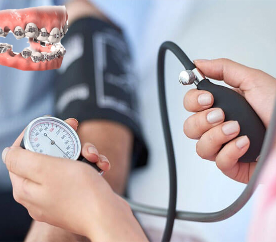 تاثیر فشار خون بر درمان ارتودنسی