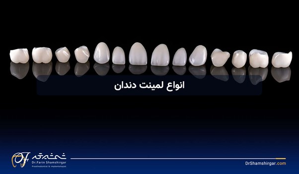 انواع لمینت دندان؛ مقایسه بهترین مدلها، مزایا و انتخاب مناسب برای لبخند شما