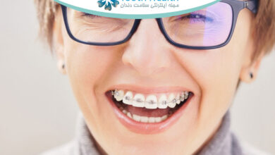 ارتودنسی در سنین بالا؛ آیا محدودیت دارد؟