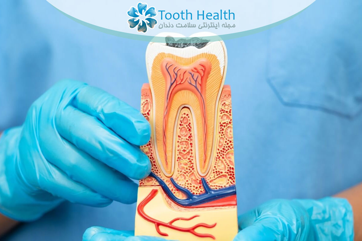 عصب کشی دندان چیست؟ مراحل، مزایا، معایب و ماندگاری