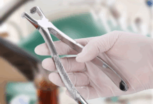 راهنمای جامع خرید فورسپس دندانپزشکی | انواع و کاربردها