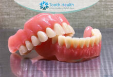 راهنمای کامل نگهداری و شست و شوی پروتز دندان متحرک