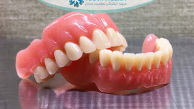 راهنمای کامل نگهداری و شست و شوی پروتز دندان متحرک