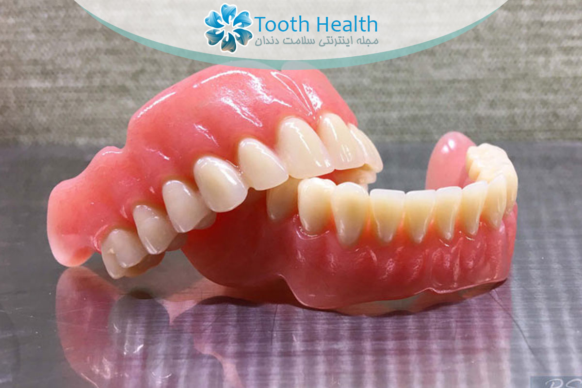 راهنمای کامل نگهداری و شست و شوی پروتز دندان متحرک