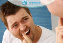 درمان لقی دندان با روش های نوین غیر جراحی