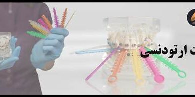 بررسی کامل انواع براکت های ارتودنسی (فلزی، سرامیکی، دیمون)