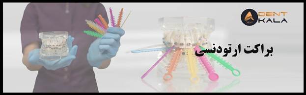 بررسی کامل انواع براکت های ارتودنسی (فلزی، سرامیکی، دیمون)