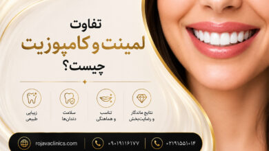 تفاوت لمینت و کامپوزیت دندان چیست؟ بررسی کامل مزایا، معایب، هزینه و ماندگاری