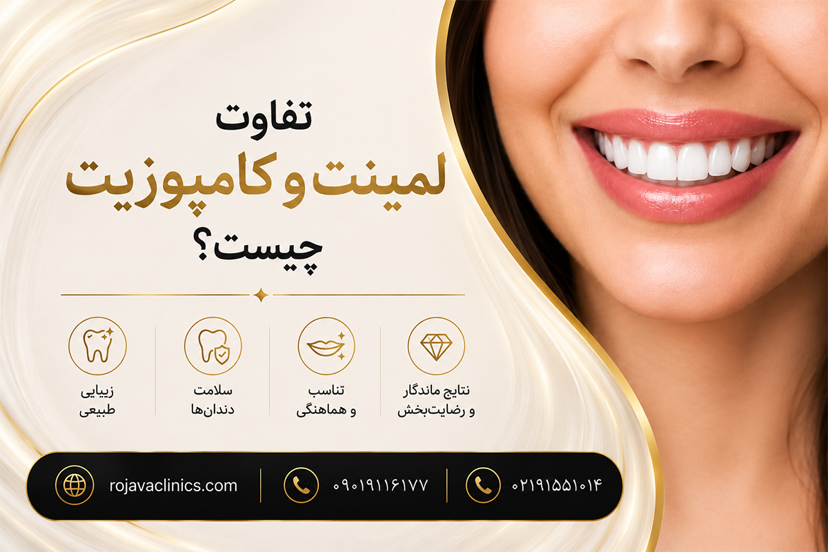 تفاوت لمینت و کامپوزیت دندان چیست؟ بررسی کامل مزایا، معایب، هزینه و ماندگاری