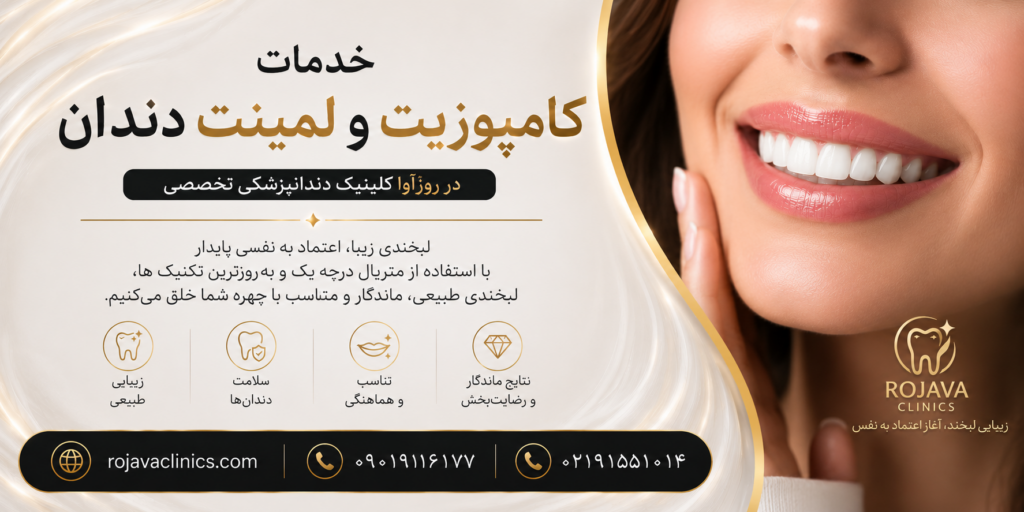 خدمات کامپوزیت و لمنیت دندان در روژآوا کلنیک؛ کلینیک تخصصی دندانپزشکی در کرمانشاه