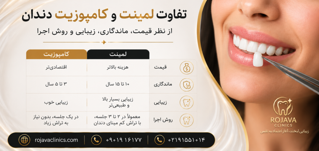 تفاوت لمینت سرامیکی و کامپوزیت دندان؛ بررسی قیمت، دوام و نتیجه نهایی