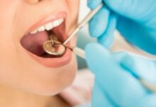 چرا رستا کلینیک برای خدمات دندانپزشکی با بیمه انتخاب مناسبی است؟