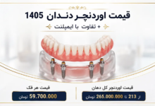 قیمت اوردنچر دندان سال 1405 – تفاوت اوردنچر با ایمپلنت