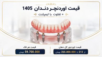قیمت اوردنچر دندان سال 1405 – تفاوت اوردنچر با ایمپلنت
