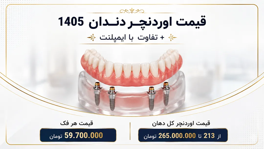 قیمت اوردنچر دندان سال 1405 – تفاوت اوردنچر با ایمپلنت